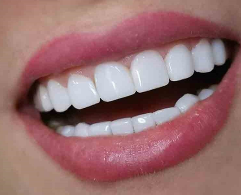 دندان سالم و زیبا
