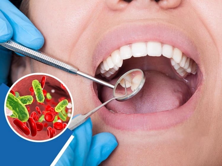 عفونت-دندان-