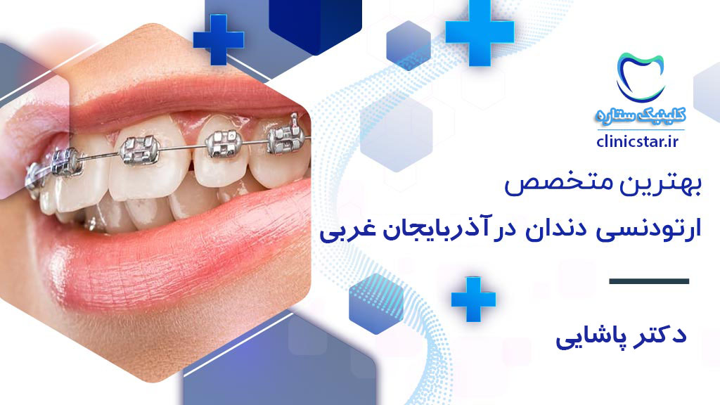 یهترین ارتودنسی